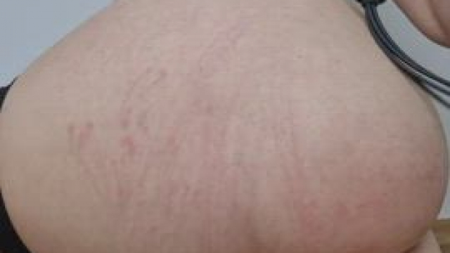 Ouch, I hit it right there:3 [F]