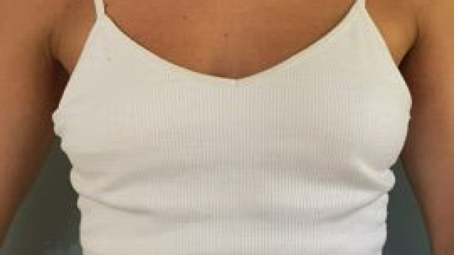 Tanlines on my boobs