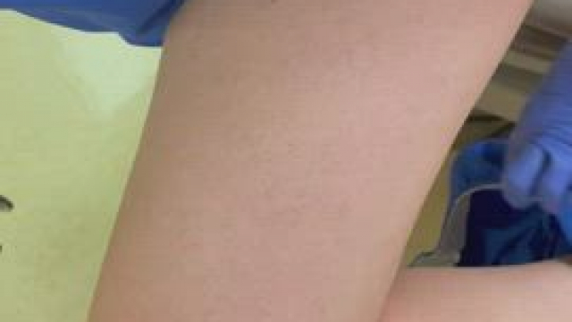 Nurse Dixie just welcoming her new patient