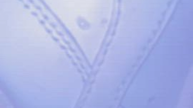 Would it be prettier with more hair