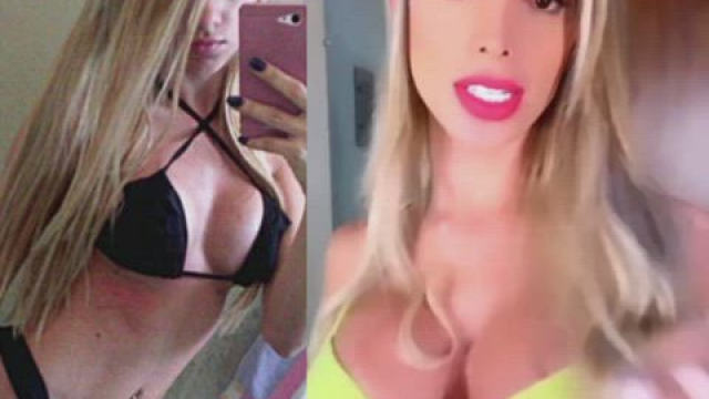 [Ts] First Breast implants at 18, and third at 24