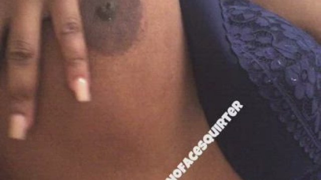 I woke up like this! It was even running down the sides of my legs