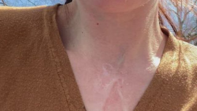 Just a little outdoor aftermath