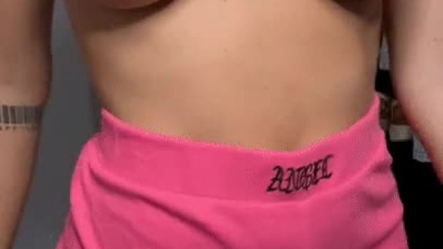 Wonderful job by my surgeon