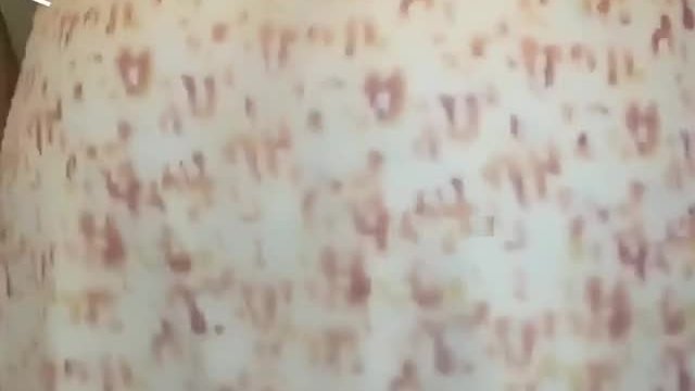 [f] I miss sundress season 