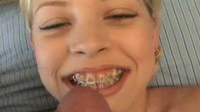 Do you like her braces?