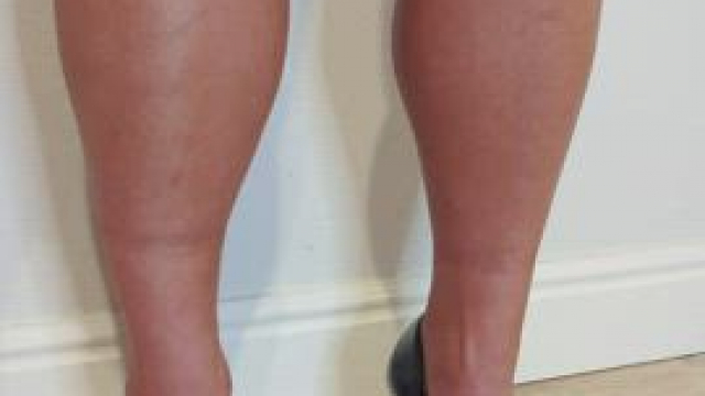 My new straitjacket is a great tool to keep me compliant!