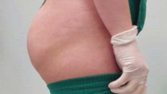 Nurse just trying to get her scrubs on