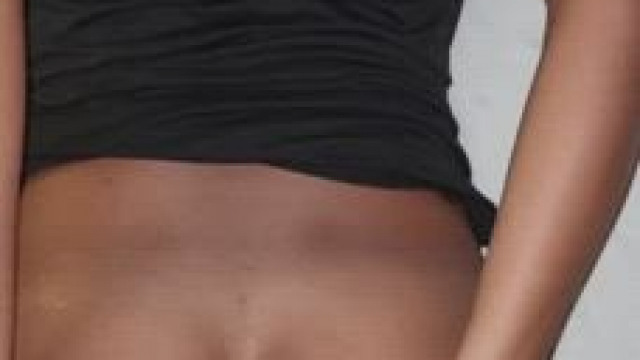 He says I'm double tight in prone bone position